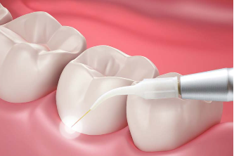 Gum Disease Treatment